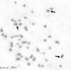 field_featured_image