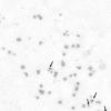 field_featured_image